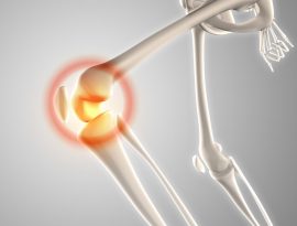 Bone strength