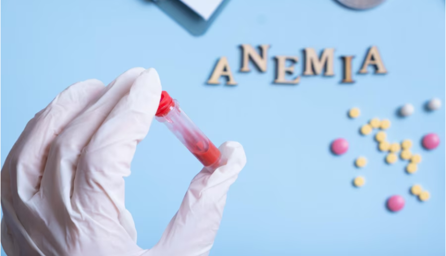 anemia